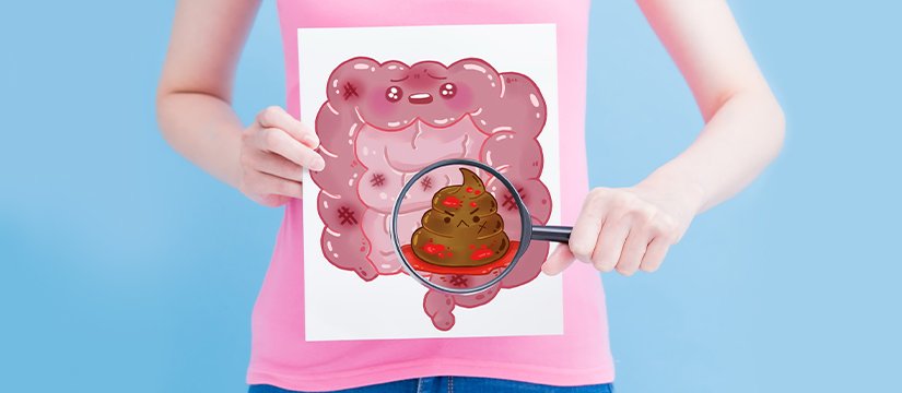 Blood in Stools Image