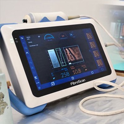 FibroScan Liver Test